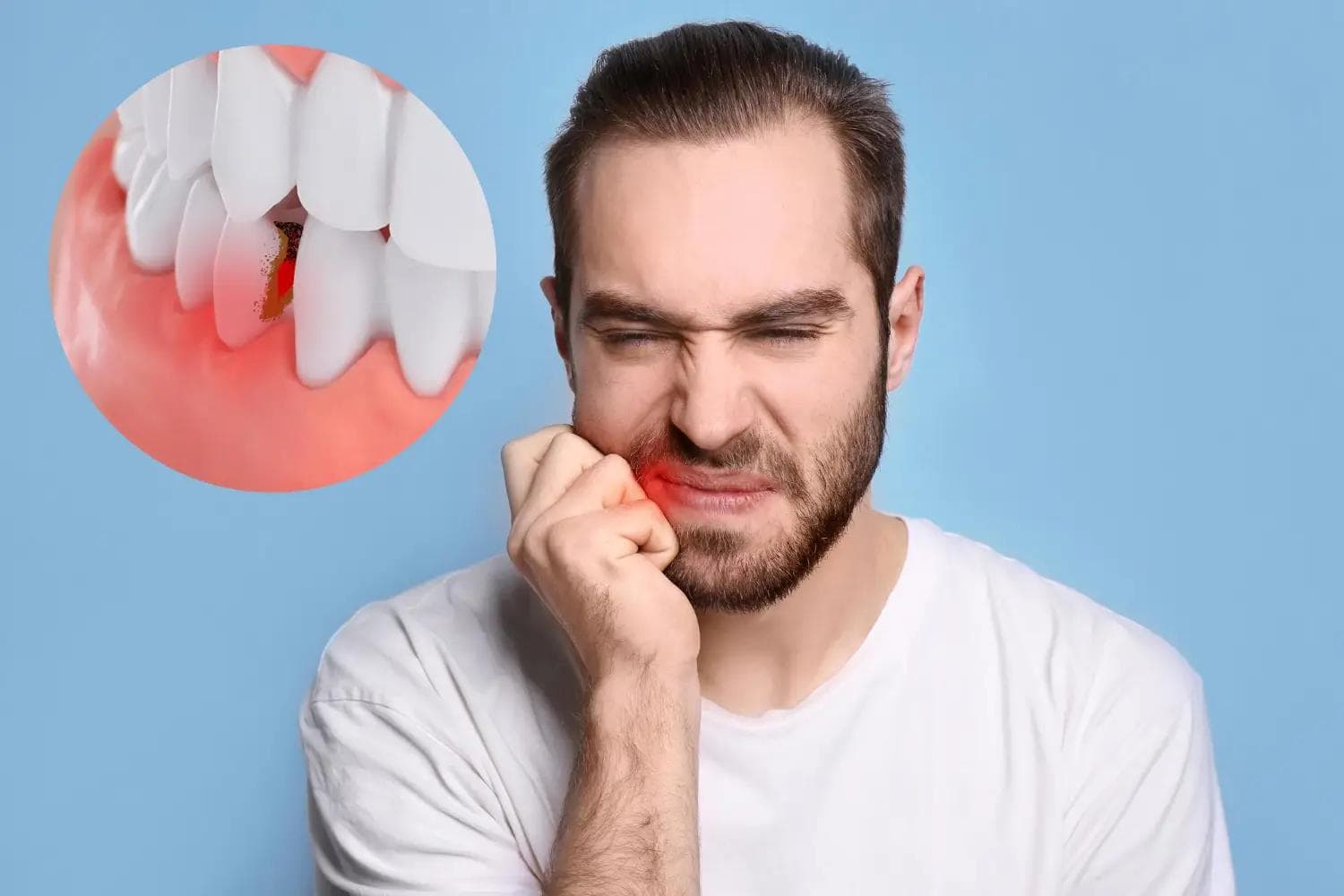 Bruxism: Ghid complet de la diagnostic la tratament