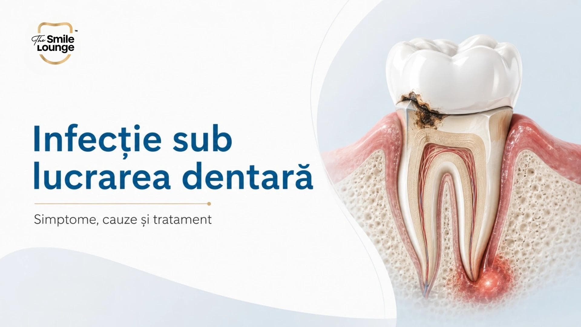 Infecție sub lucrare dentară: simptome și tratament