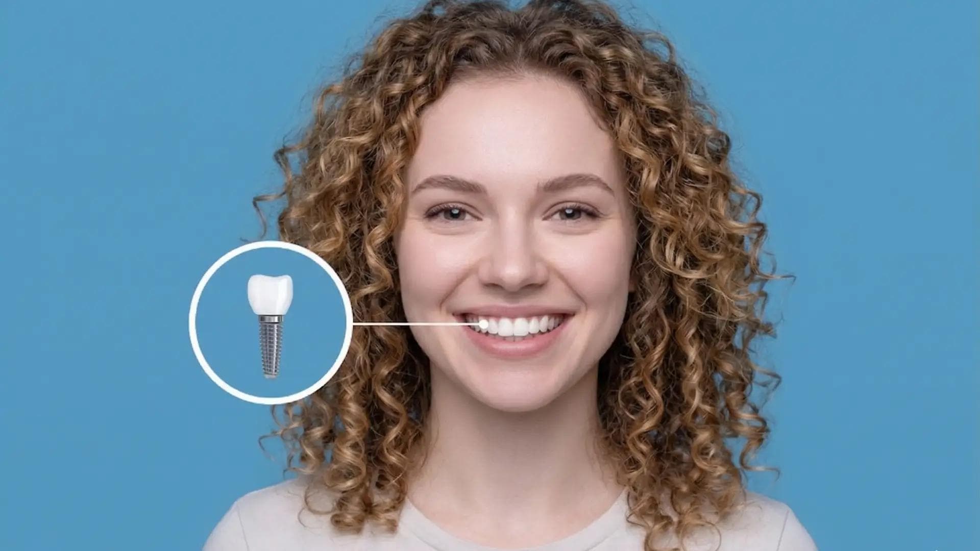 Implant dentar Constanța 2026: Prețuri și procedură