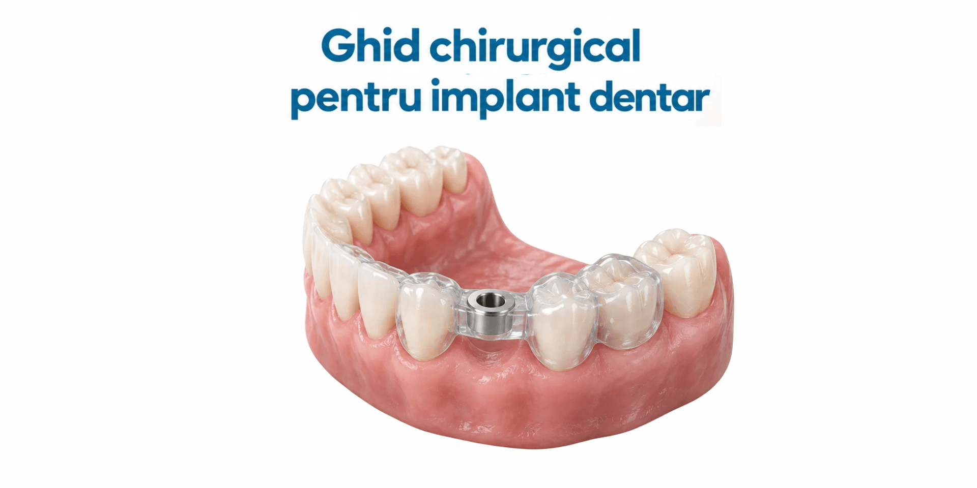 Ghid chirurgical pentru implant dentar: rol, beneficii și limite